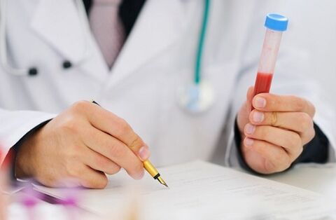 testy na prostatitidu k předepisování léků